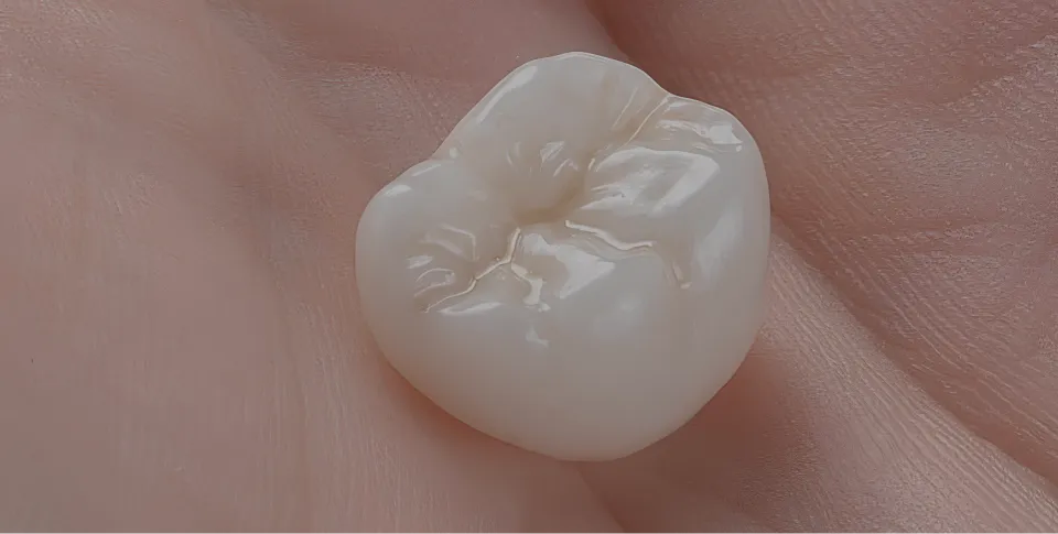 Dental Crowns at Divine Dental in Santa Fe, New Mexico