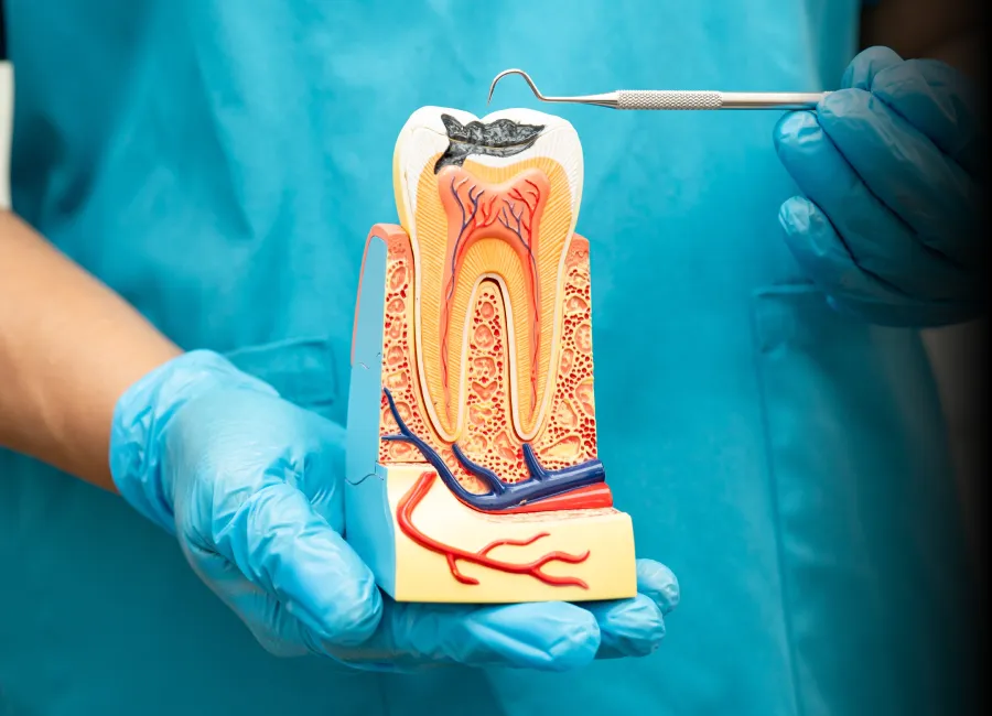 Amalgam Dental Fillings at [pracitice_name] in Santa Fe, NM