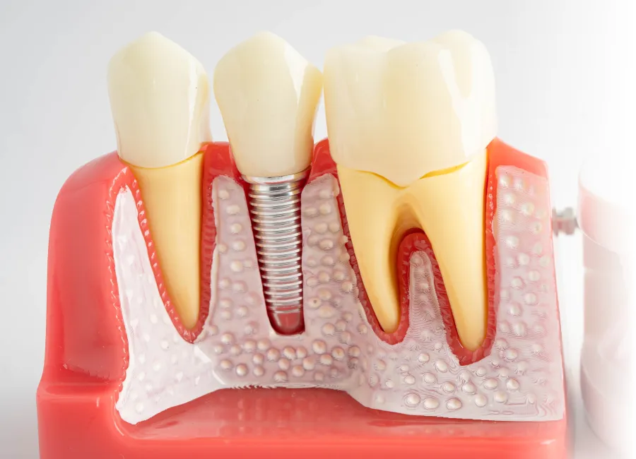 Denture Care at Divine Dental in Santa Fe, NM 