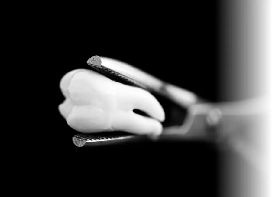 Tooth Extractions at Divine Dental in Santa Fe, NM 