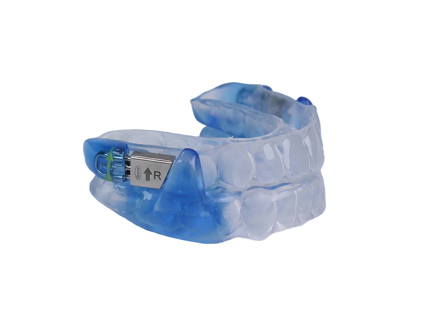 Vivos sleep apnea oral appliance